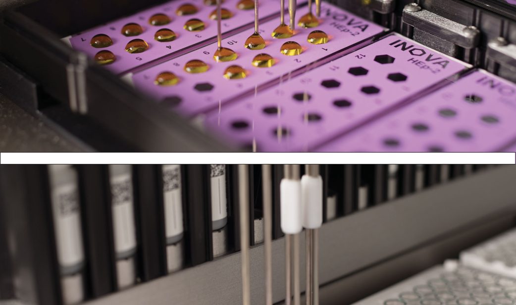 Produktnyheder fra Werfen